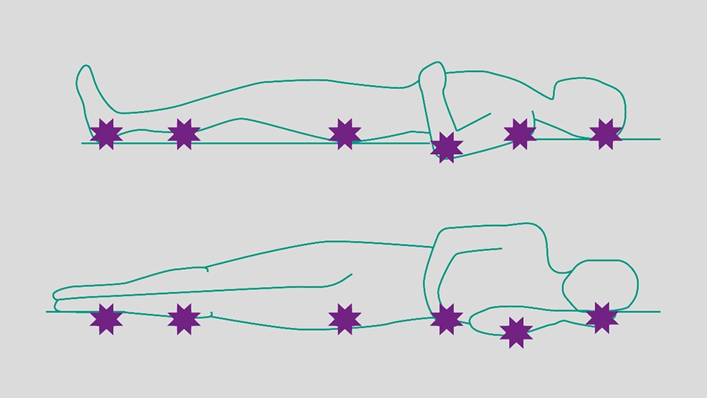 In einer Grafik einer liegenden Person werden die sechs verschiedenen Druckgeschwürpunkte von den Füßen bis zum Kopf dargestellt